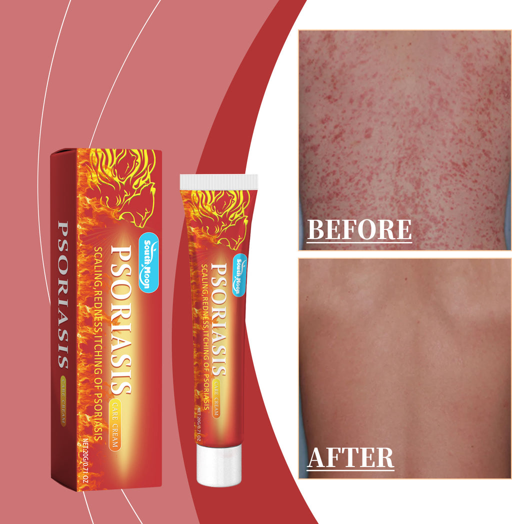 Skin Care Cream, A Gentle Formula To Moisturize Dry Skin