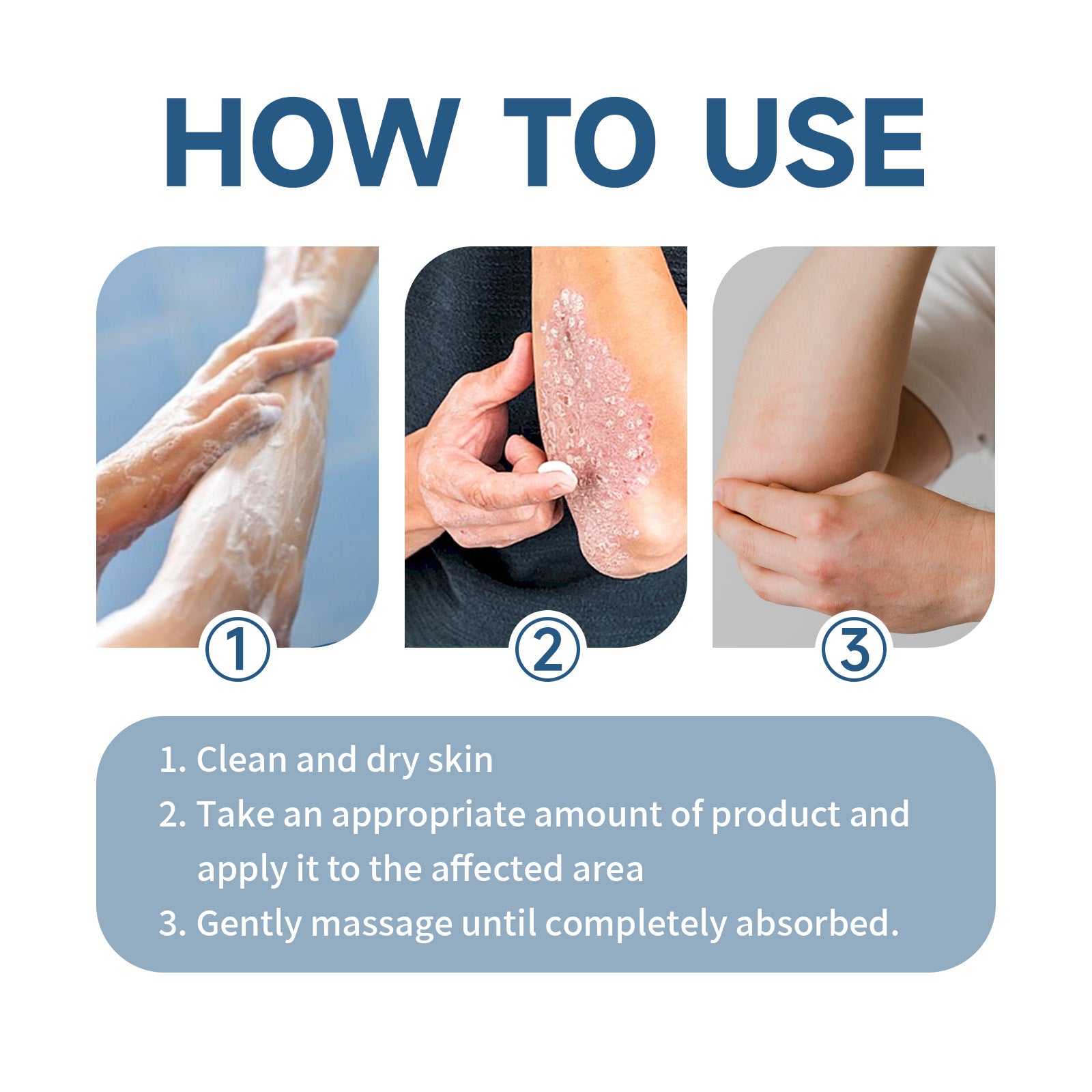 Moisturizing Cream, Moisturizing And Repairing Skin Care Cream For Itchy And Swollen Skin